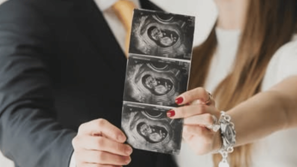 el ultrasonido de mentira de Mariana Cantú y Samuel García demuestra un bebé IA de Mariana Rodríguez por el aesthetic